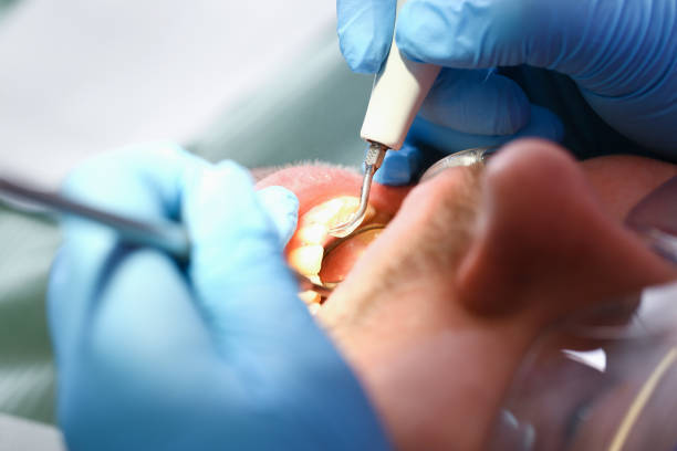 Best Broken or Cracked Tooth Emergency Dentist in Raoul, GA