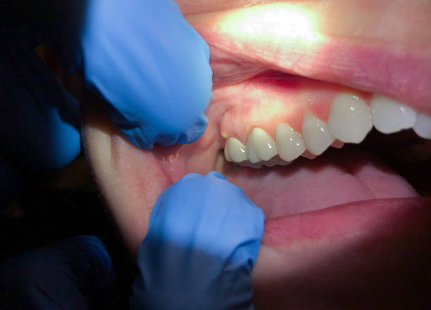 Best Pediatric Emergency Dentist in Raoul, GA