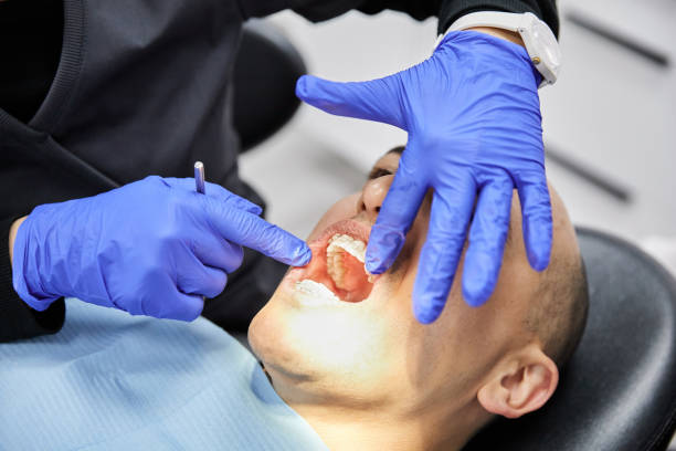 Best Emergency Root Canal Treatment in Raoul, GA
