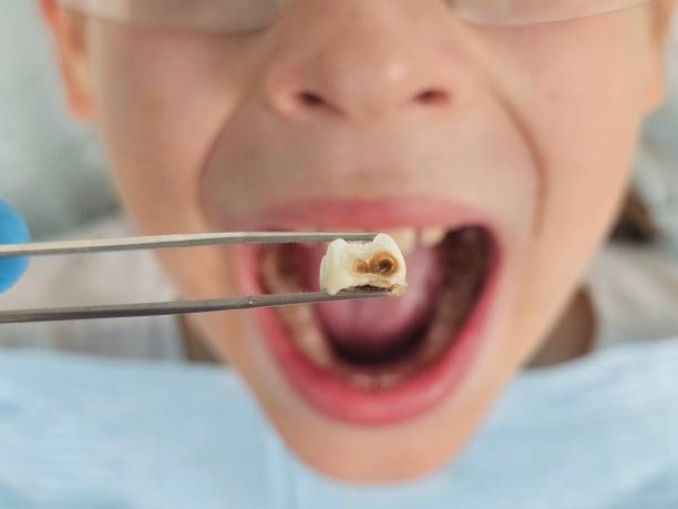Best Mobile Emergency Dentist in Raoul, GA